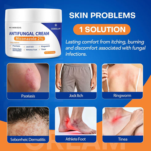 Seebeellar 2% 3.4 oz, 100g Antifungal Cream for Athletes Foot Jock Itch Ringworm Seborrheic Dermatitis Folliculitis
