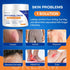 Seebeellar 2% 3.4 oz, 100g Antifungal Cream for Athletes Foot Jock Itch Ringworm Seborrheic Dermatitis Folliculitis