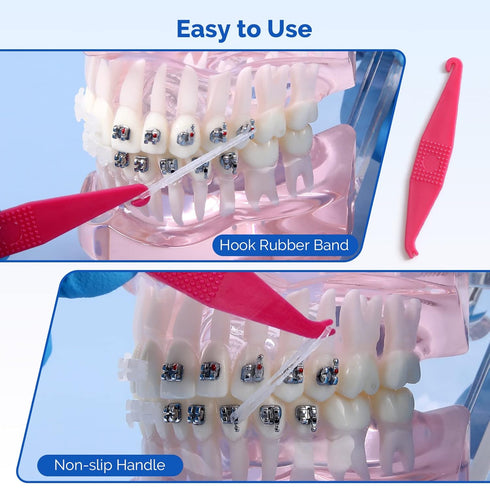 JMU Clear Orthodontic Elastics 3/8 Medium, 300 Pack Latex Free Dental Rubber Bands Made in USA