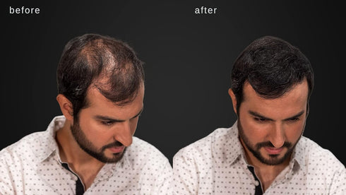 LUXE Hair Thickening Fibers - CONFIDENCE IN A JAR – Hypoallergenic, Dermatologist Tested – 2 Months+ Supply, Medium
