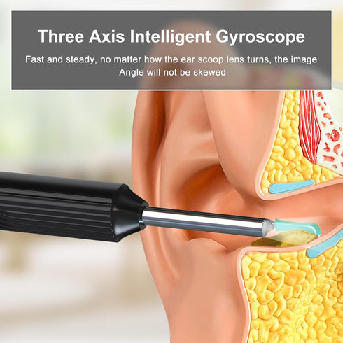 Ear Wax Removal Tool, Ear Cleaner with 1080P HD Otoscope Camera, Ear Cleaning Kit for iPhone and Android Phones
