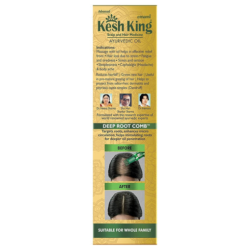 Ayurvedic Hair Oil with Bhringraj & Amla, 10.14 Fl Oz/300ml, Enhances Hair Growth and Reduces Hairfall