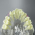 Dental Malocclusion Orthodontic Treatment Teeth Model with Metal Brackets, Colorful Ties, and Chains