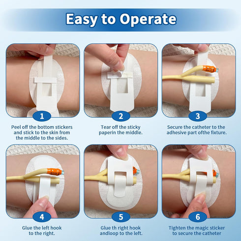 reevnnmer 20 Packaged,Self-High pcs Foley Catheter Stabilization Devices,Sterile Individually Adhesive Catheter