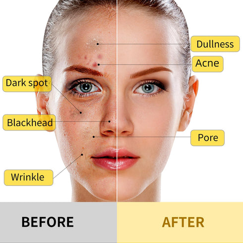 Turmeric Vitamin C Clay Mask, Deep Cleansing Facial Mask with Kaolin Clay and Aloe for Hydrating Skin Care