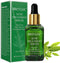 Tea Tree Acne Treatment Serum, 17ml Clear Skin Serum for Severe Acne, Pimple Remover and Skin Repair (0.6oz)