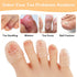 30Pcs Silicone Toe Protectors, Breathable Gel Anti-Friction Toe Caps Guards for Men Women, Soft Clear Toe Sleeves for