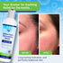 Seborrheic & Atopic Dermatitis Gentle Face Wash - Natural & Organic Cleanser for Sensitive Skin