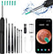 Ear Wax Removal Tool, Ear Cleaner with 1080P HD Otoscope Camera, Ear Cleaning Kit for iPhone and Android Phones
