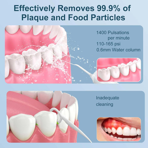 Cordless Water Flosser for Teeth - 300ML Rechargeable Oral Irrigator with 5 Modes for Home Use, Travel Friendly (White)