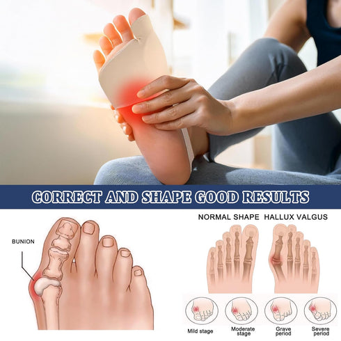 tongtonglovely Professional Bunion Corrector, Orthopedic Toe Separator, Beige, Elastic Fabric, Adjustable Fit, Pain
