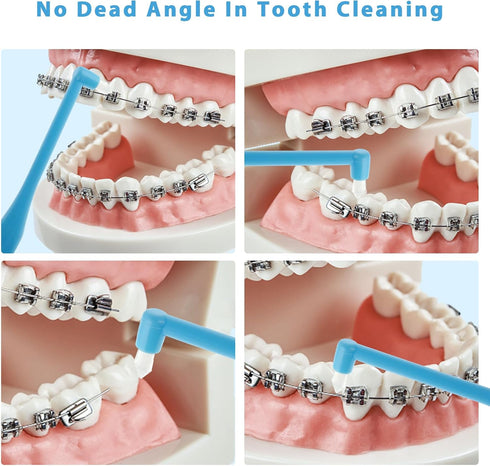 Single End Tufted Toothbrush, 5 Pcs Interspace Tooth Brush Tapered Trim Tooth Cleaner Interdental Toothbrush Tuft Gap Toothbrush for Orthodontic Detail Cleaning