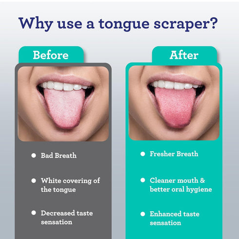 GuruNanda Tongue Scraper for Adults (4-Pack) with Travel Case, 420 Medical Grade Stainless Steel for Fresh Breath