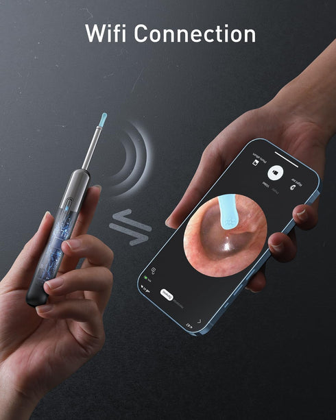 Wireless WiFi Ear Wax Removal Cleaner, 1080P HD Camera Lens, 8 Pcs Ear Set - Hassle-Free Ear Cleaning Kit (Black)