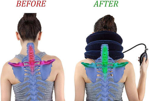 Cervical Neck Traction Device, Inflatable Neck Stretcher for Chronic Neck & Shoulder Pain Relief, Neck Brace