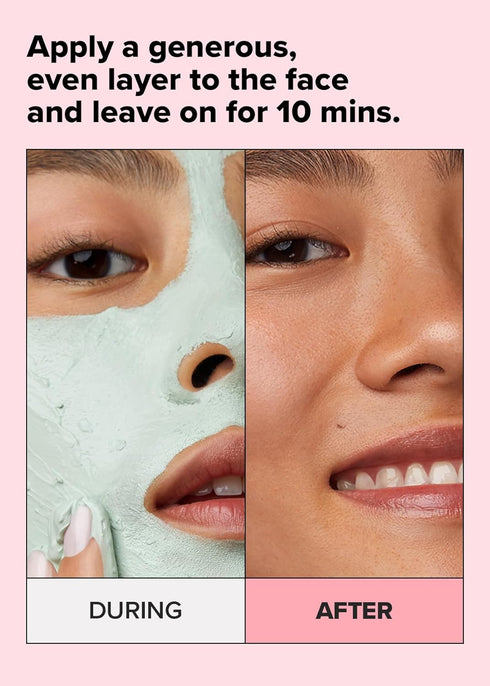 I DEW CARE Wash-off Clay Mask - Yoga Kitten | Blemish-prone Skin Treatment with Kaolin and Tea Tree Extract