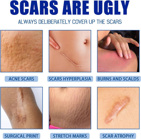 URABOS (1pcs) Scar Cream,Scar Removal Cream,Silicone Scar Gel,Scar Silicone Gel,Scar Gel,Scar Cream for Surgical Scars