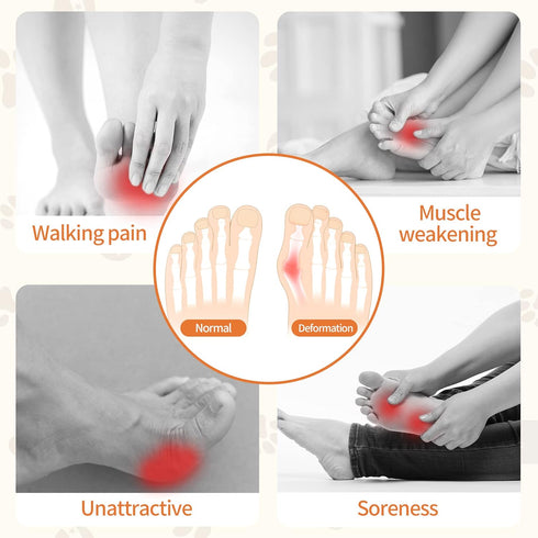 2 Pairs Gel Metatarsal Pads - Honeycomb Fabric Forefoot Pads for Men & Women, High Heels Comfort Inserts for Pain Relief