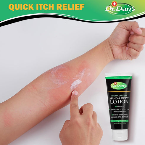 Dr. Dan's Hydrocortisone Hand and Body Lotion - Anti Itch Lotion for Men and Women (3 Pack)
