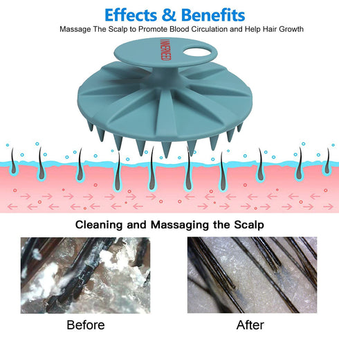 INNERNEED Scalp Massager Shampoo Brush - Wet & Dry Manual Scalp Care Head Scrubber for Hair Growth, Dark Green