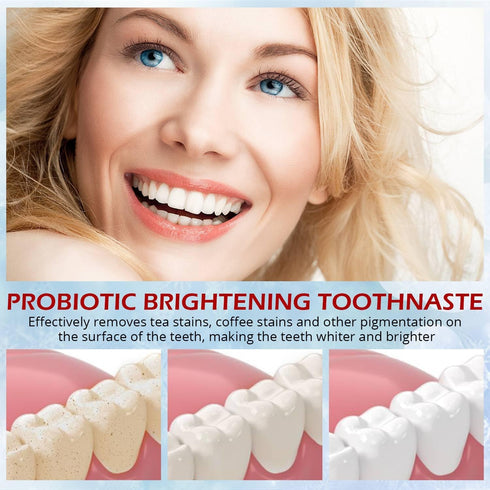 OHZH SP-6 (3PCS) Probiotics Whitening Toothpaste - Probiotics for Teeth Whitening and Gum Health - Enamel-Safe