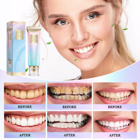 2Pcs Niacinamide Whitening Toothpaste, Fresh Breath Nicotinamide Dazzle White Toothpaste, Remove Tooth Stains