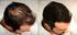 Volumizing Hair Fibers with Real Keratin for Thinning Hair, 60 Days+ Supply, Dermatologist Tested, Black