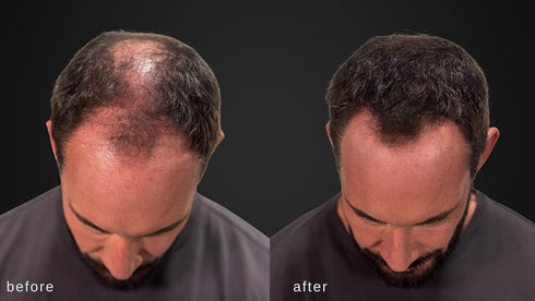 LUXE Hair Thickening Fibers - CONFIDENCE IN A JAR – Hypoallergenic, Dermatologist Tested – 2 Months+ Supply, Medium