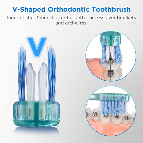V+A Shaped Orthodontic Toothbrush for Braces, Soft Bristles, with 6 Interdental Brushes, 6 Count