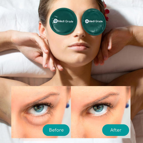 Medi Grade Cooling Eye Mask for Puffy Eyes, Reusable Gel Eye Mask with Thermo-bag for Dark Circles Relief