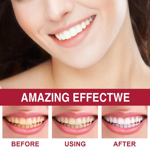 2 Pcs Sp-6 Probiotic Ultra Whitening Toothpaste, Deep Cleaning Care, Stain Removing, Fresh Breath