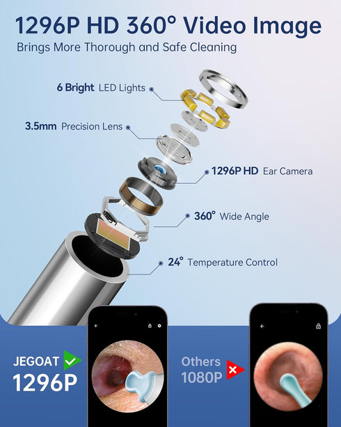 Ear Wax Removal Tool Camera, Ear Cleaner with 1296P HD Scope, 6 LED Lights and 12 Ear Picks