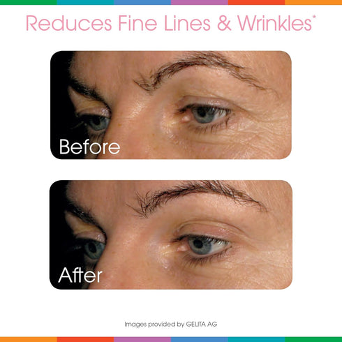 Sparkle Wellness Skin Boost Plus (Acai Lemonade) | Collagen Powder Supplement with VERISOL, Vitamin C, Hyaluronic Acid