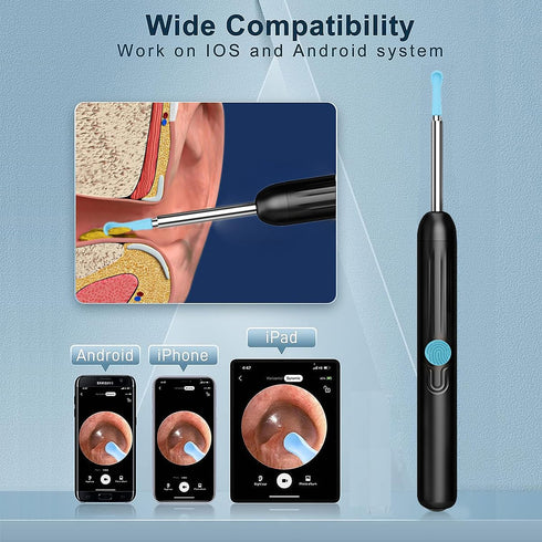 RSRNKXC 1080P 6 Lights,IP67 8 Ear Wax Removal Kit,Earwax Removal Tools with HD Camera and LED Waterproof,Multi-Purpose