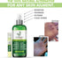 Thyme Out Plus Eczema Treatment, Psoriasis Treatment Treats Acne, Dermatitis, Rosacea, Cold Sores, Pet Rashes, Bug