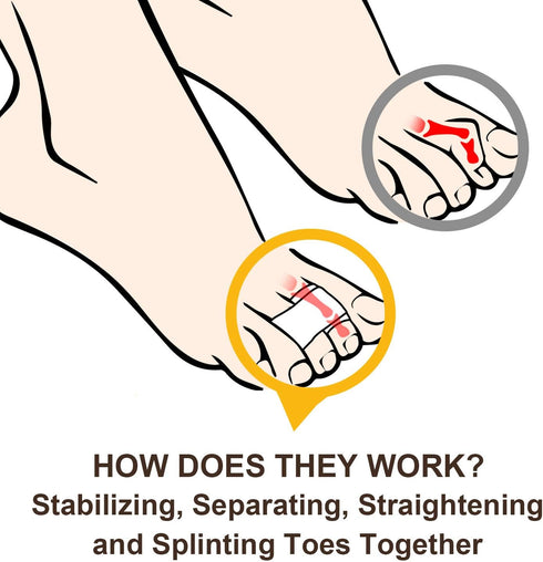 Welnove 6Pcs Hammer Toe Straightener, Cushioned Bandages for Correcting Hammer, Broken, Crooked & Overlapping Toes