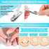 Modacraft 11PCS Ingrown Toenail Removal Kit, Effective Treatment with Toenail Clippers for Thick Toenails