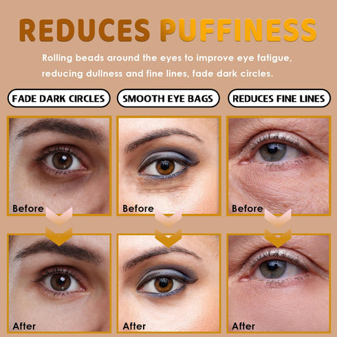 IFVGFB 3 Pcs Castor Oil Frankincense Eye Serum, Reduces Dark Circles & Puffiness, Alleviate Wrinkles & Eyes Fatigue