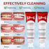OHZH SP-6 (3PCS) Probiotics Whitening Toothpaste - Probiotics for Teeth Whitening and Gum Health - Enamel-Safe