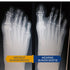 Bunion Corrector for Women - Big Toe Straightener, Ultra-Thin & Discreet Sock for Hallux Valgus Relief (Med-Right)