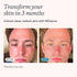 MDacne Vitamins and Minerals Skin Clearing Supplements, 30 Vegan Capsules for Clear Skin, Redness & Pore-Clogging