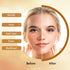POP MODERN.C Kojic Acid Soap, 3PCS Turmeric Soap for Dark Spot Remover, 3x100g