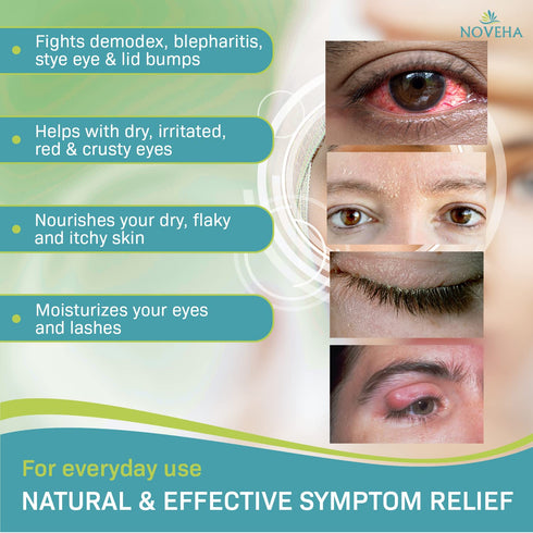 NOVEHA Tea Tree Oil Foaming Cleanser, Therapeutic Daily Skincare for Eyelash & Lids, 2 Pack