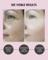 Under Eye Patches for Dark Circles and Puffiness, 15 Pairs Collagen Eye Masks for Wrinkle Reduction and Treatment