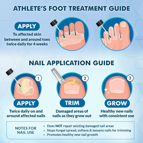 Ebanel Athlete's Foot Fungus Treatment Extra Strength, Antifungal Cream with Miconazole and Tea Tree Oil