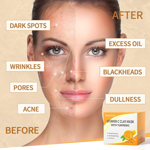 Vitamin C Face Mask with Kaolin Clay and Turmeric for Dark Spots and Dull Skin, 5.29 Oz