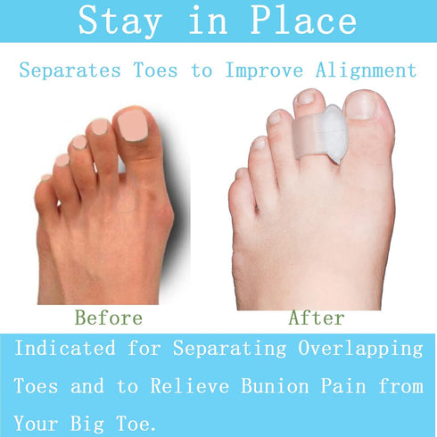Pack of 12 Gel Toe Separator, 1/4" Thick Big Toe Spacers, Single Loop Corrector and Spacer for Bunions (Clear)