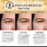 Temporary Eye Tightener Eye Cream - Instant Reduces Under-Eye Bags, Dark Circles & Puffiness, Anti-Aging, 0.5 oz