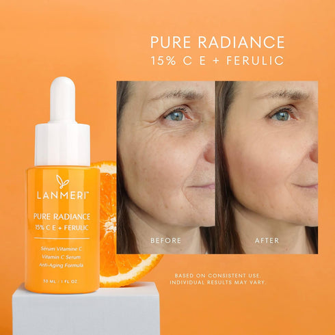 Vitamin C Face Serum - CE Ferulic Facial Serum with 15% Pure L-Ascorbic Acid, Anti Aging Skin Brightening Serum 30ml