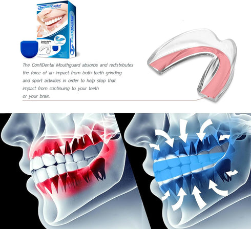 Pack of 3 Moldable Mouth Guards for Teeth Grinding | Includes 2 Regular and 1 Heavy Duty Guard for Bruxism